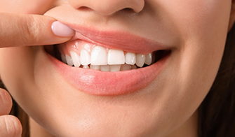 Close up of a person pointing to their gums before receiving periodontal services in Georgia