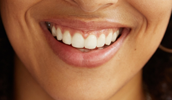 Close up of a person with a gummy smile
